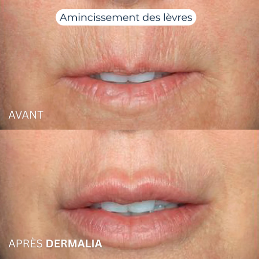 Formule Découverte