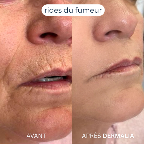 Formule Complète