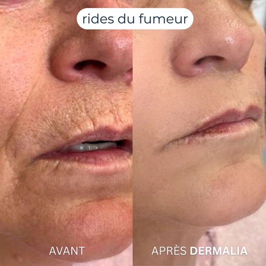 Formule Découverte